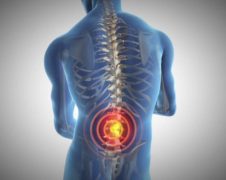 Information About Back Pain